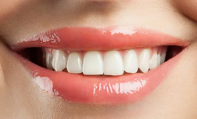 Beautiful smile after cosmetic dental treatment